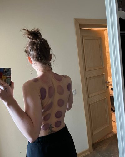 Abrikosa Nude Leaks