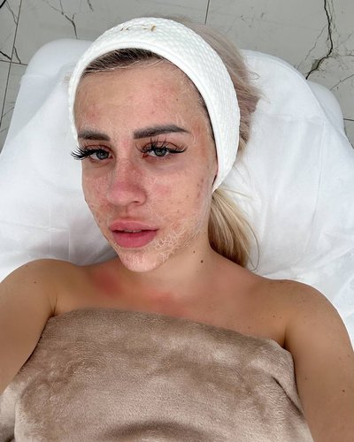 Слив Кенели Сайкс