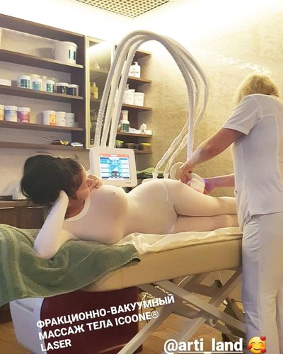 Слив Бьянки